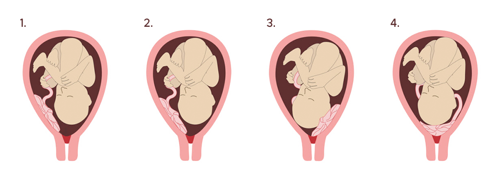 placenta-positions